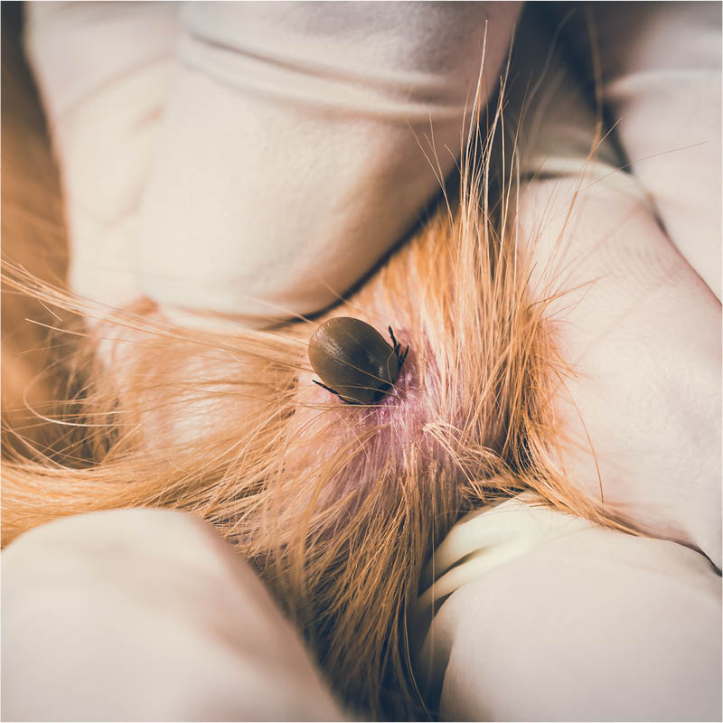 Keeping clear of ticks and Lyme disease